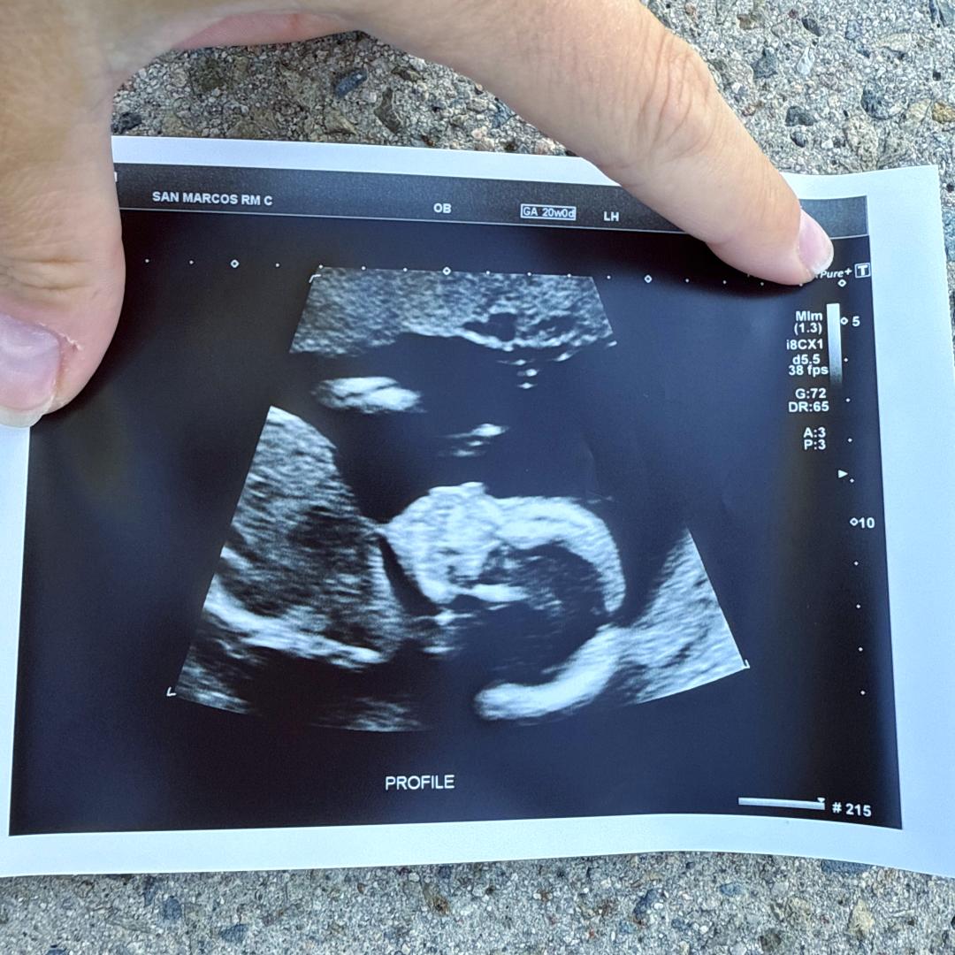 Photo shared by Lauren for their Babylist baby registry.