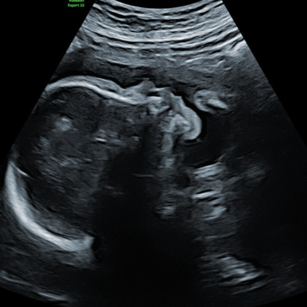 Photo shared by Nicole for their Babylist baby registry.