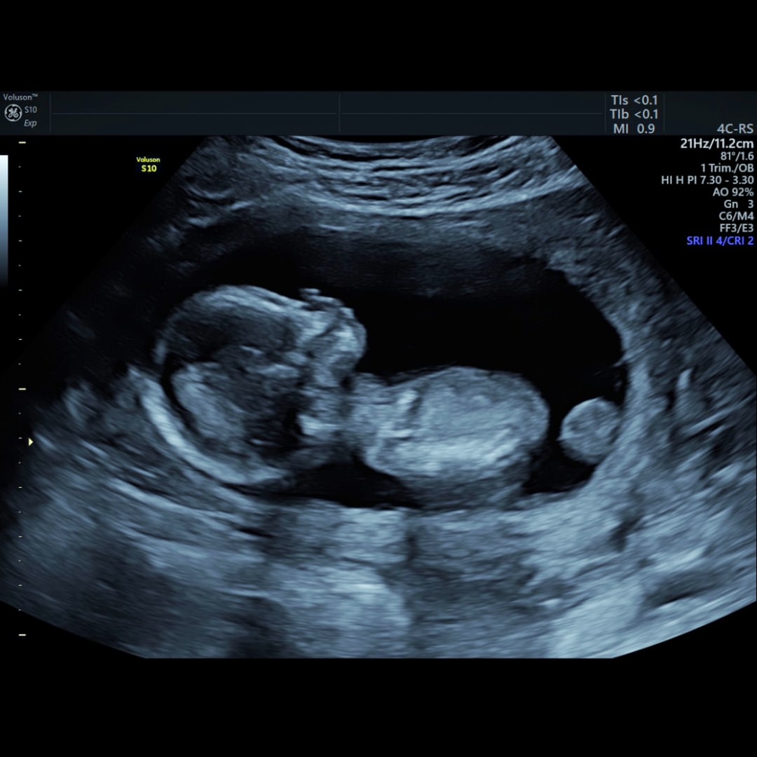 Photo shared by India for their Babylist baby registry.