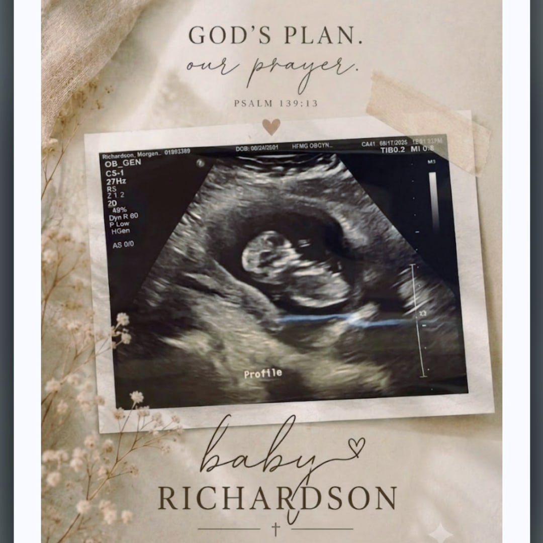 Photo shared by Morgan for their Babylist baby registry.