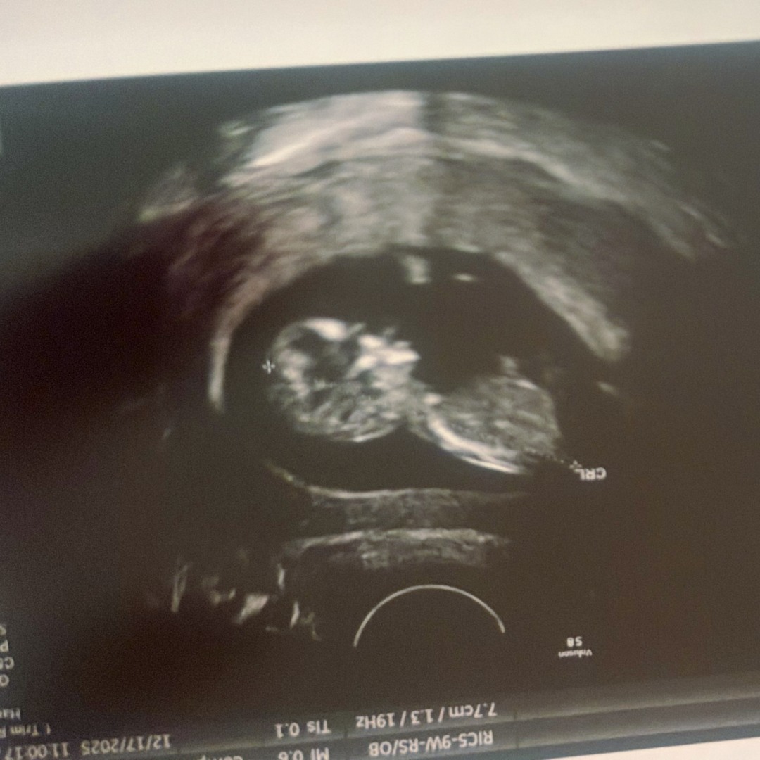 Photo shared by Jasmine for their Babylist baby registry.