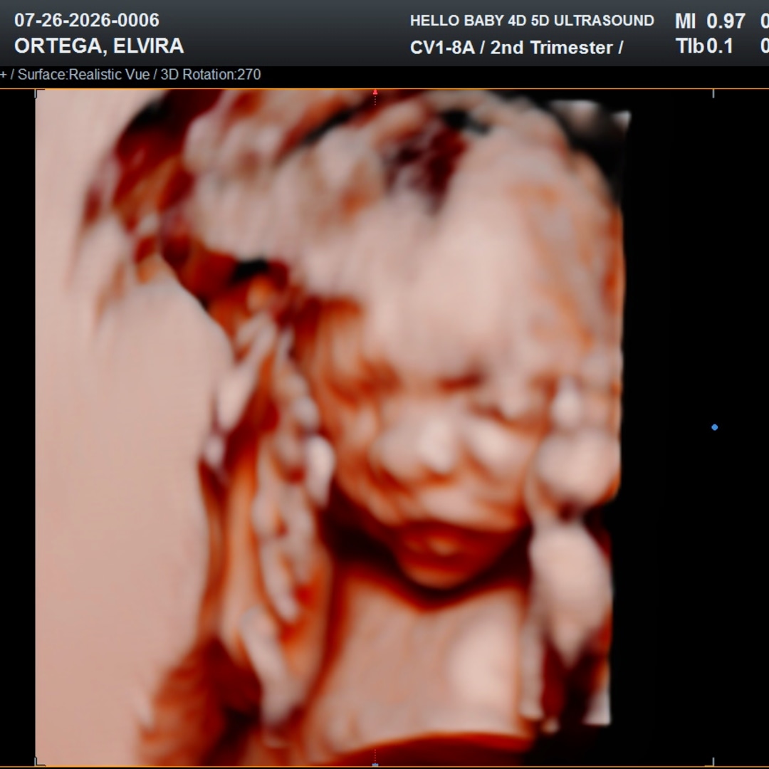 Photo shared by Elvira for their Babylist baby registry.
