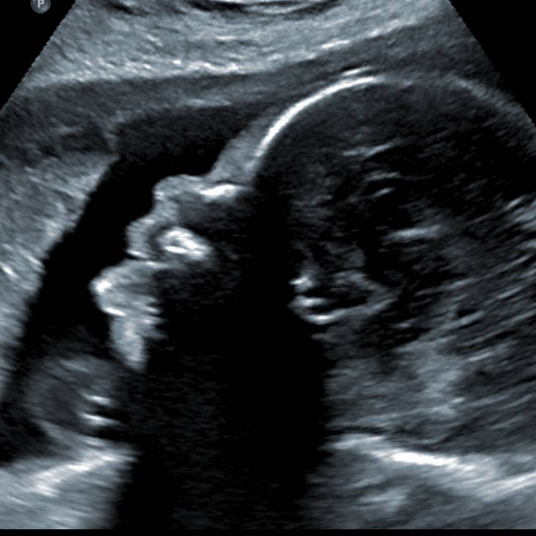 Photo shared by Emma for their Babylist baby registry.