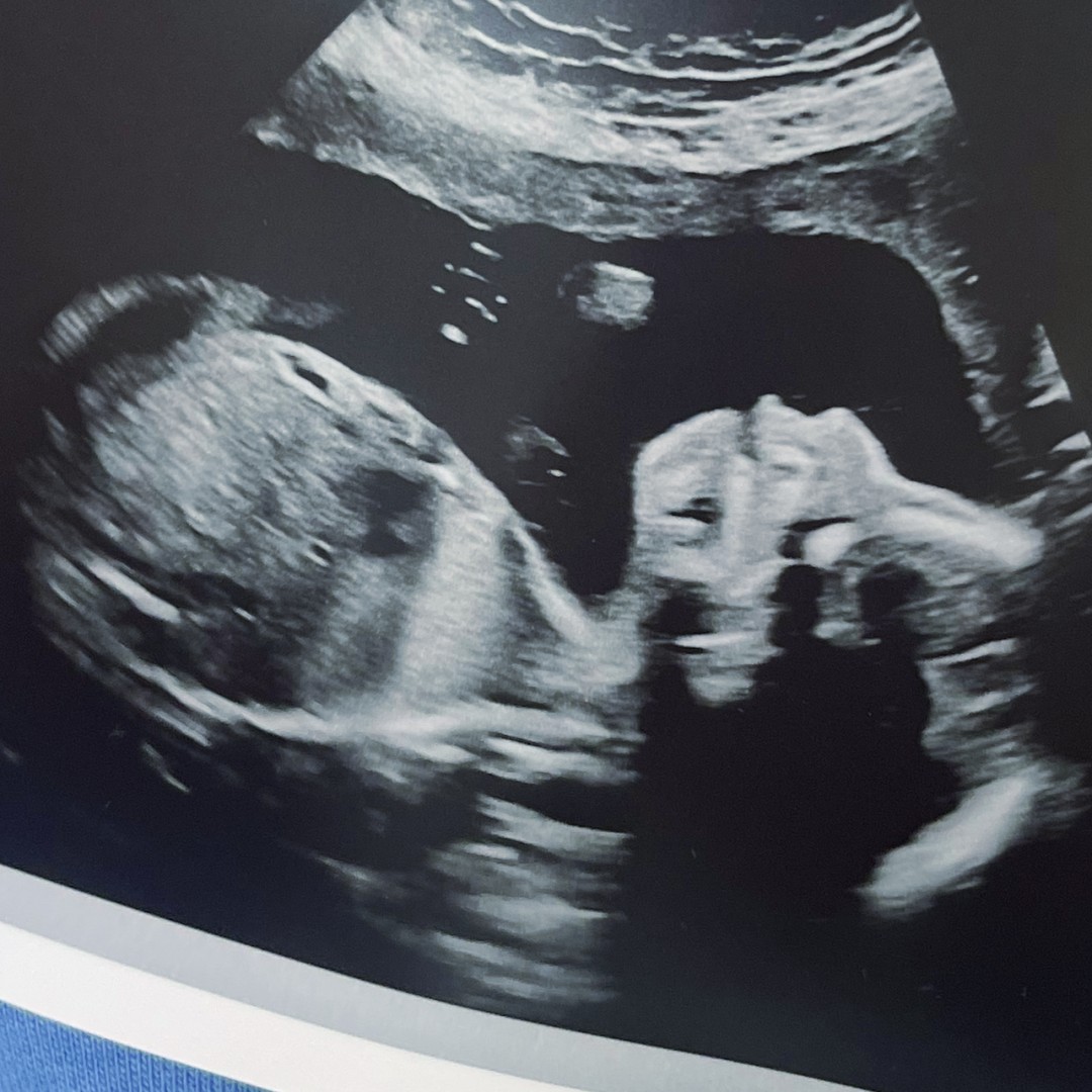 Photo shared by Stacy for their Babylist baby registry.