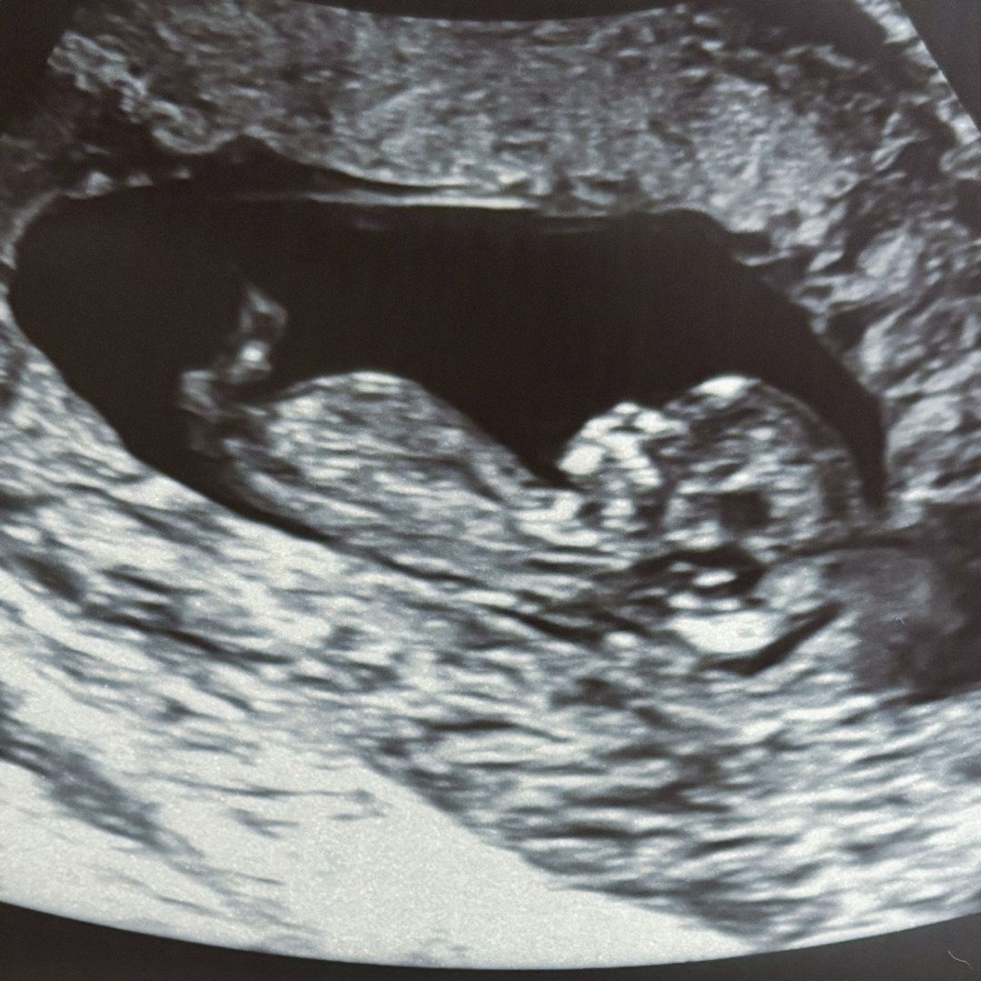 Photo shared by Hailie for their Babylist baby registry.