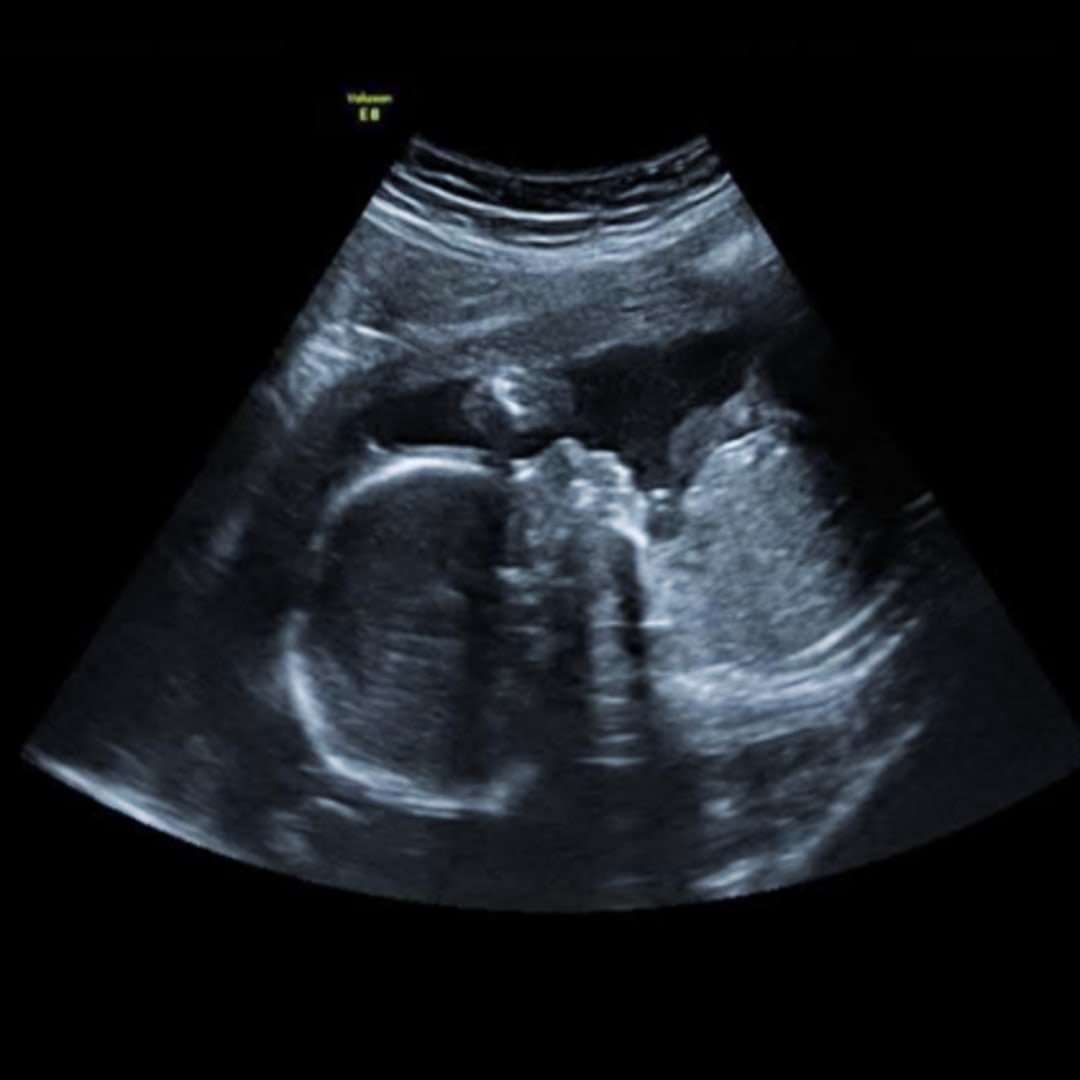 Photo shared by Jacey for their Babylist baby registry.