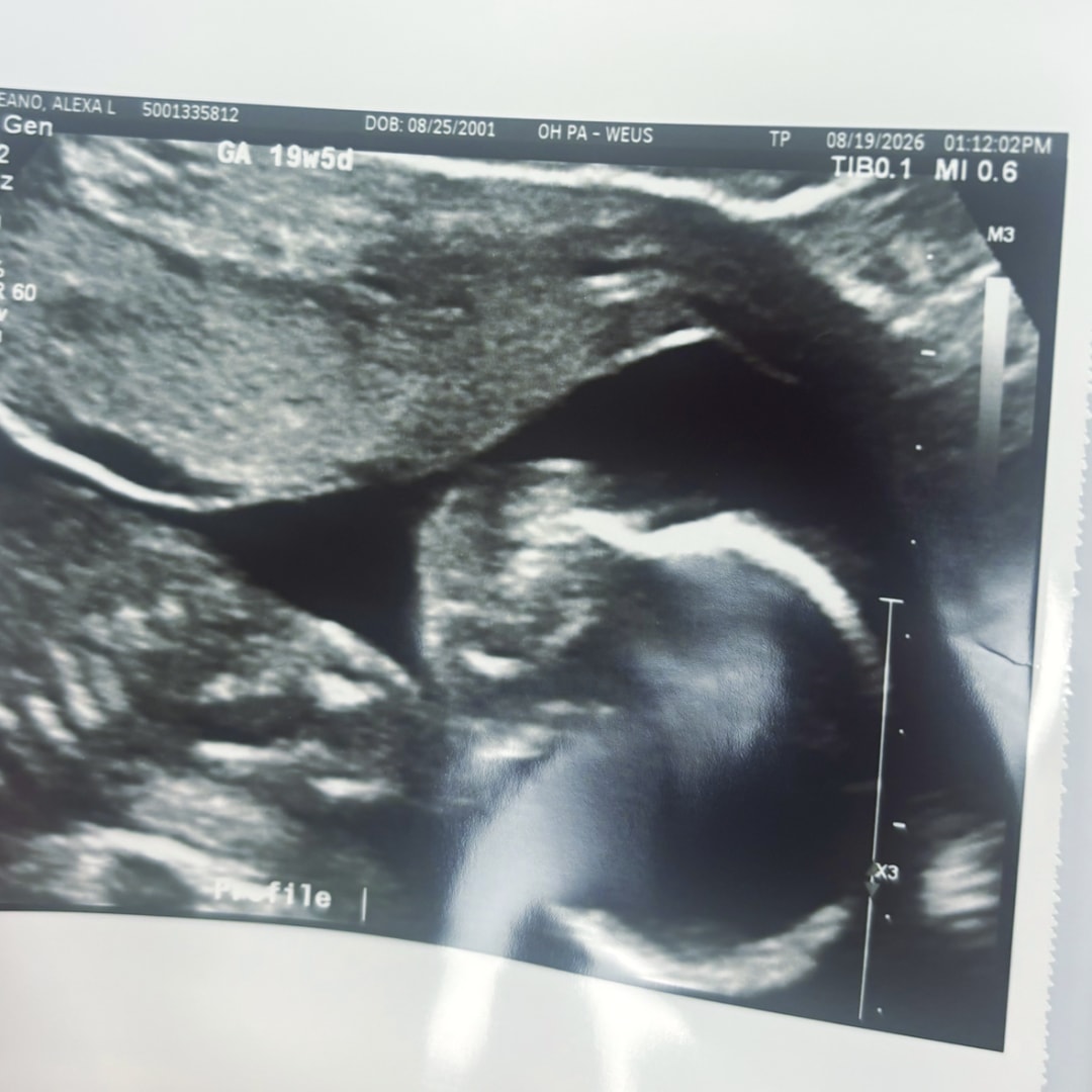 Photo shared by Alexa for their Babylist baby registry.