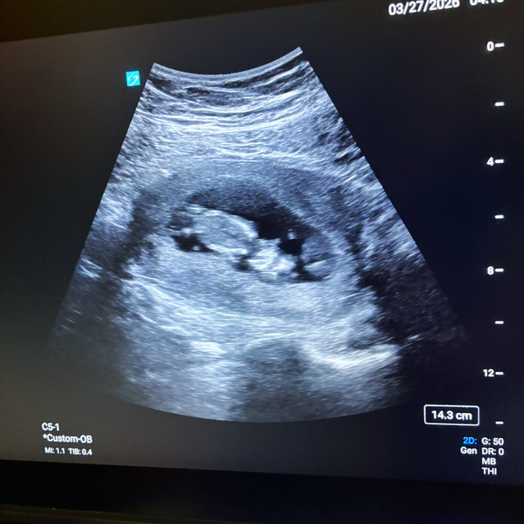 Photo shared by Amalia for their Babylist baby registry.