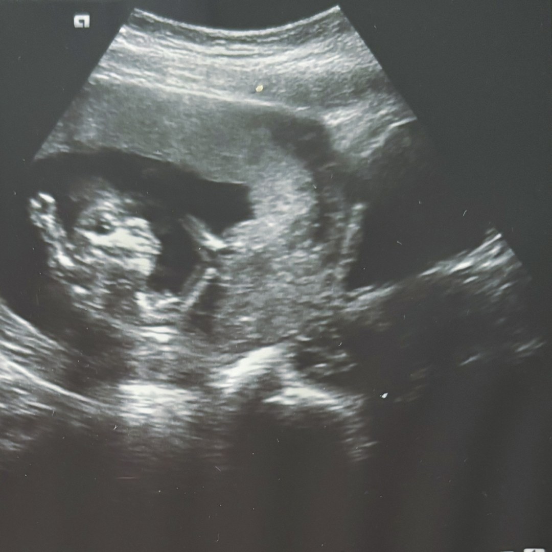 Photo shared by Elessa for their Babylist baby registry.