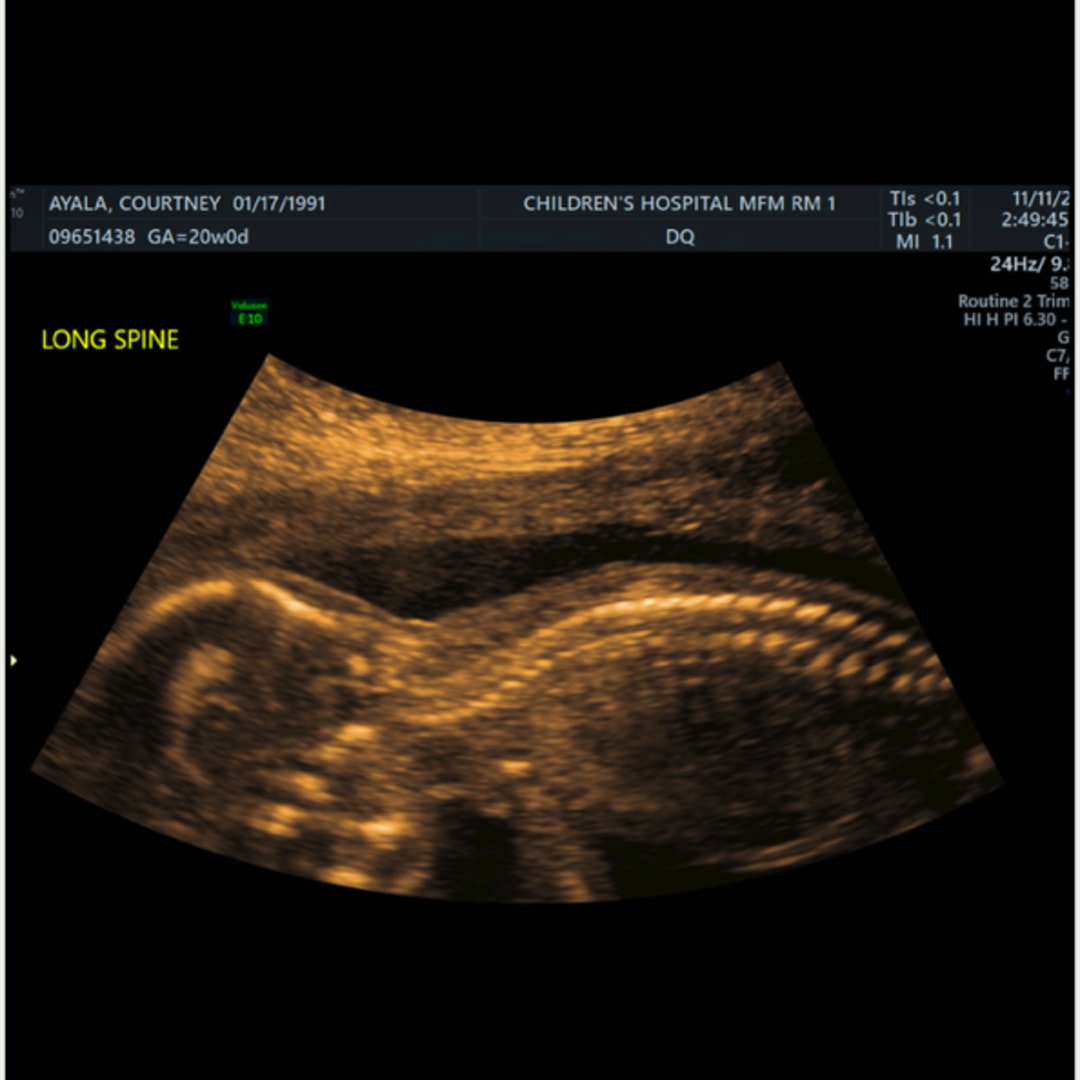 Photo shared by Courtney for their Babylist baby registry.