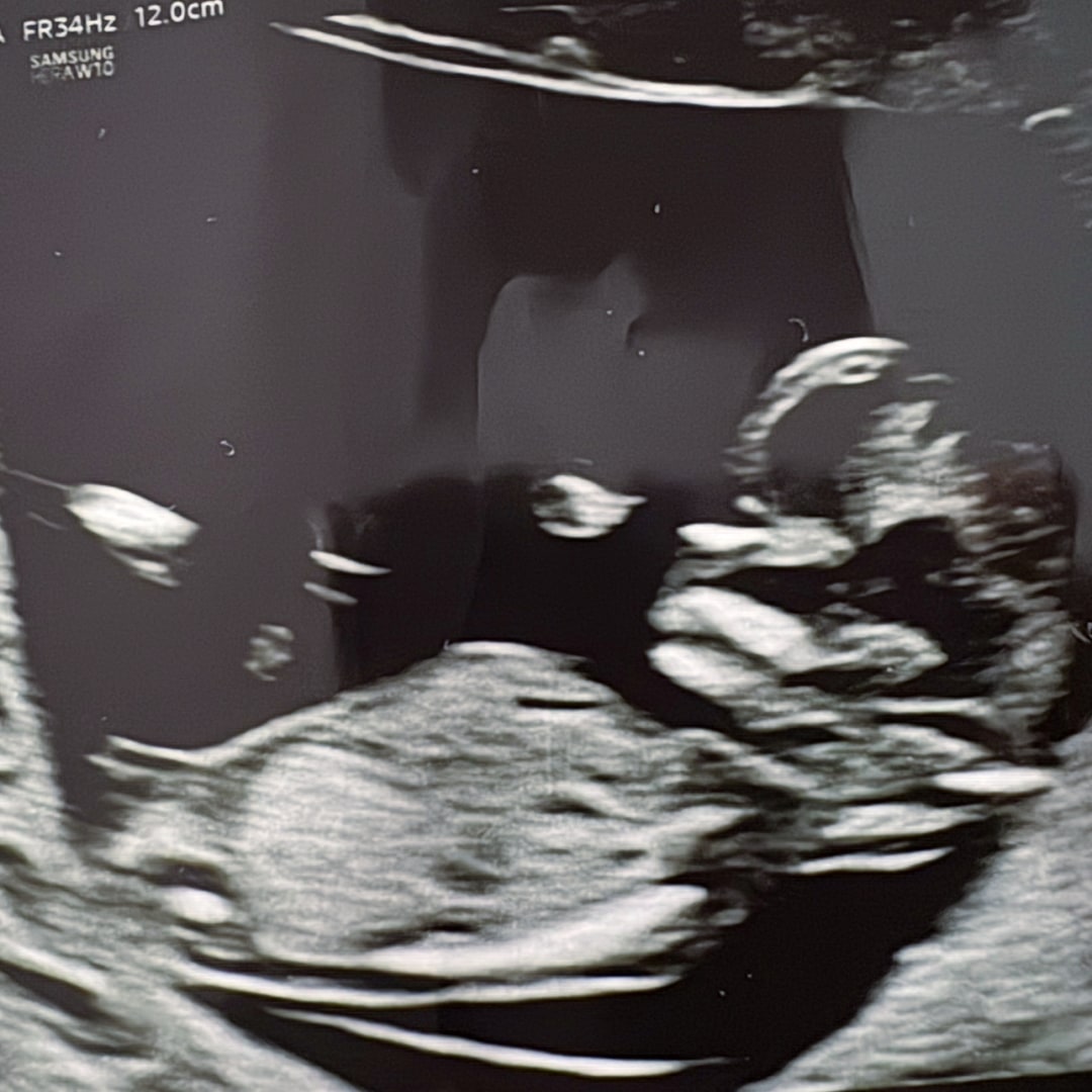 Photo shared by Karli for their Babylist baby registry.