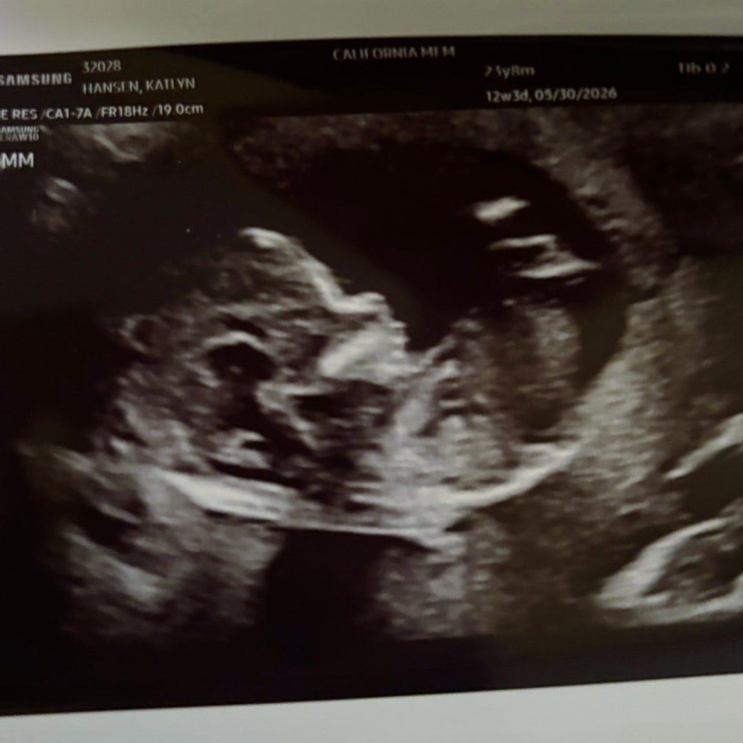 Photo shared by Katlyn for their Babylist baby registry.