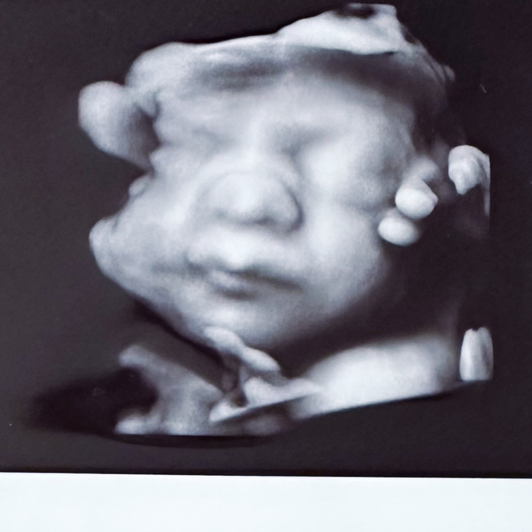 Photo shared by Angelina for their Babylist baby registry.
