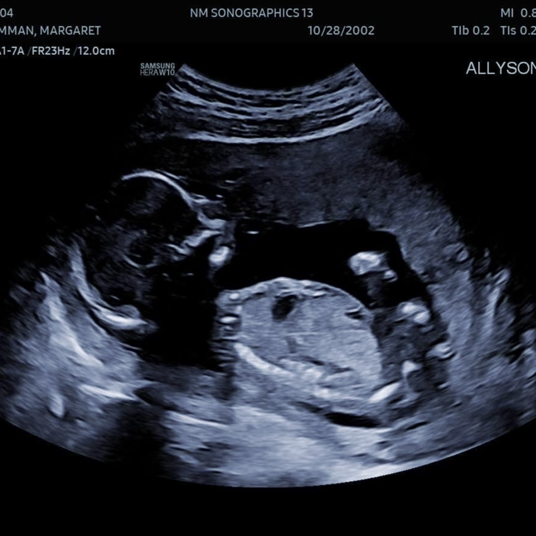 Photo shared by MargaretTaylor for their Babylist baby registry.