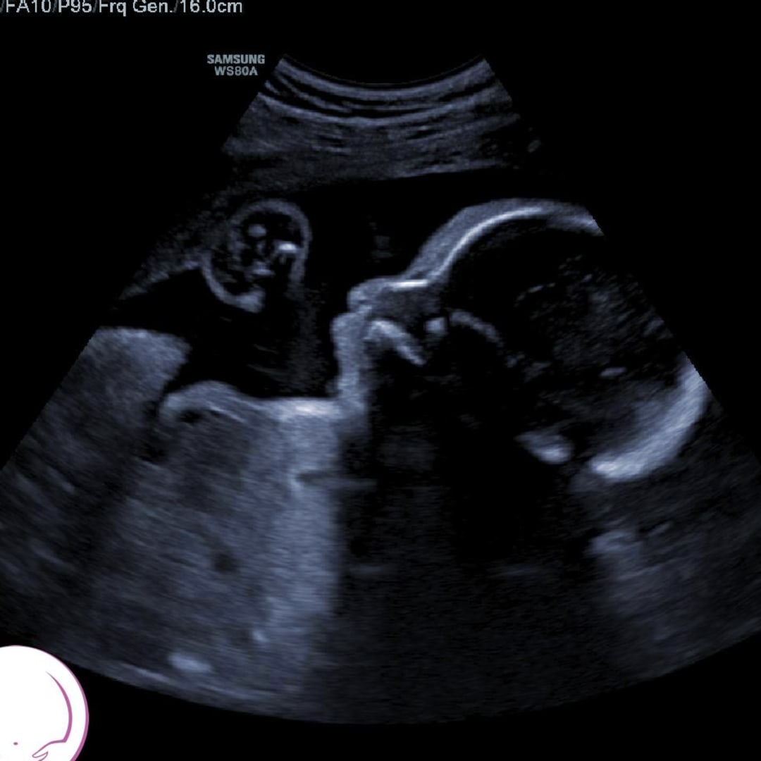 Photo shared by Janelle for their Babylist baby registry.