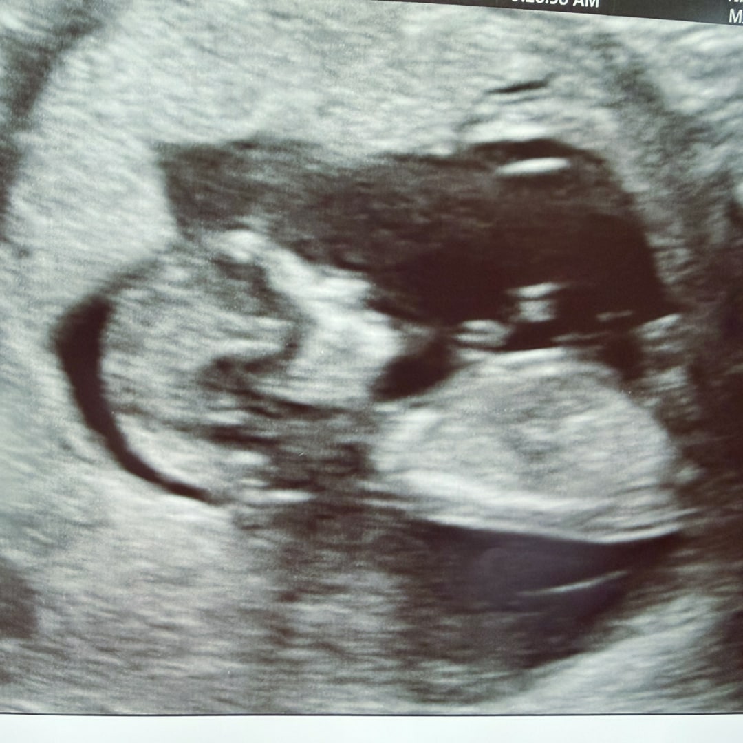 Photo shared by Angela for their Babylist baby registry.