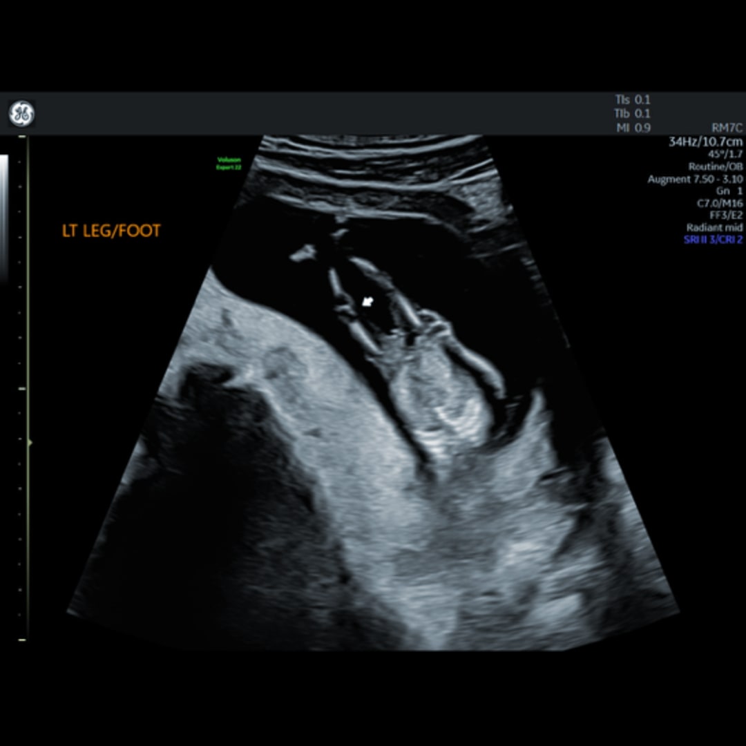 Photo shared by Josie for their Babylist baby registry.