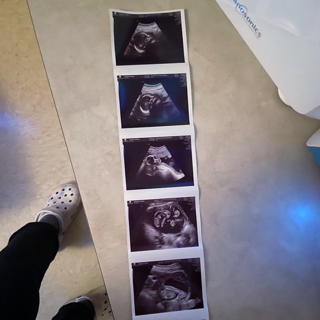 Photo shared by Laylonna for their Babylist baby registry.