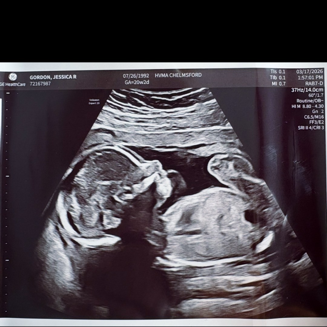 Photo shared by Jessica for their Babylist baby registry.