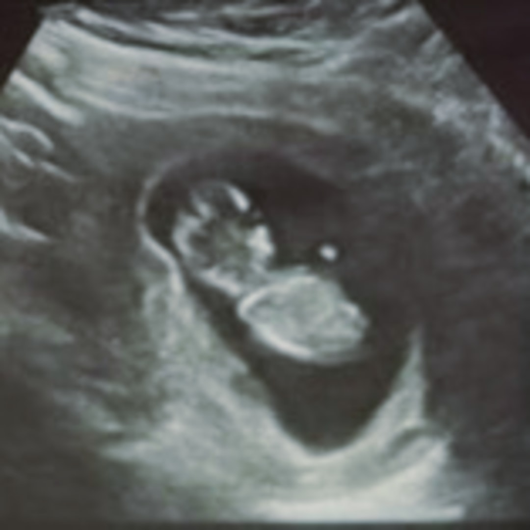 Photo shared by Siera for their Babylist baby registry.