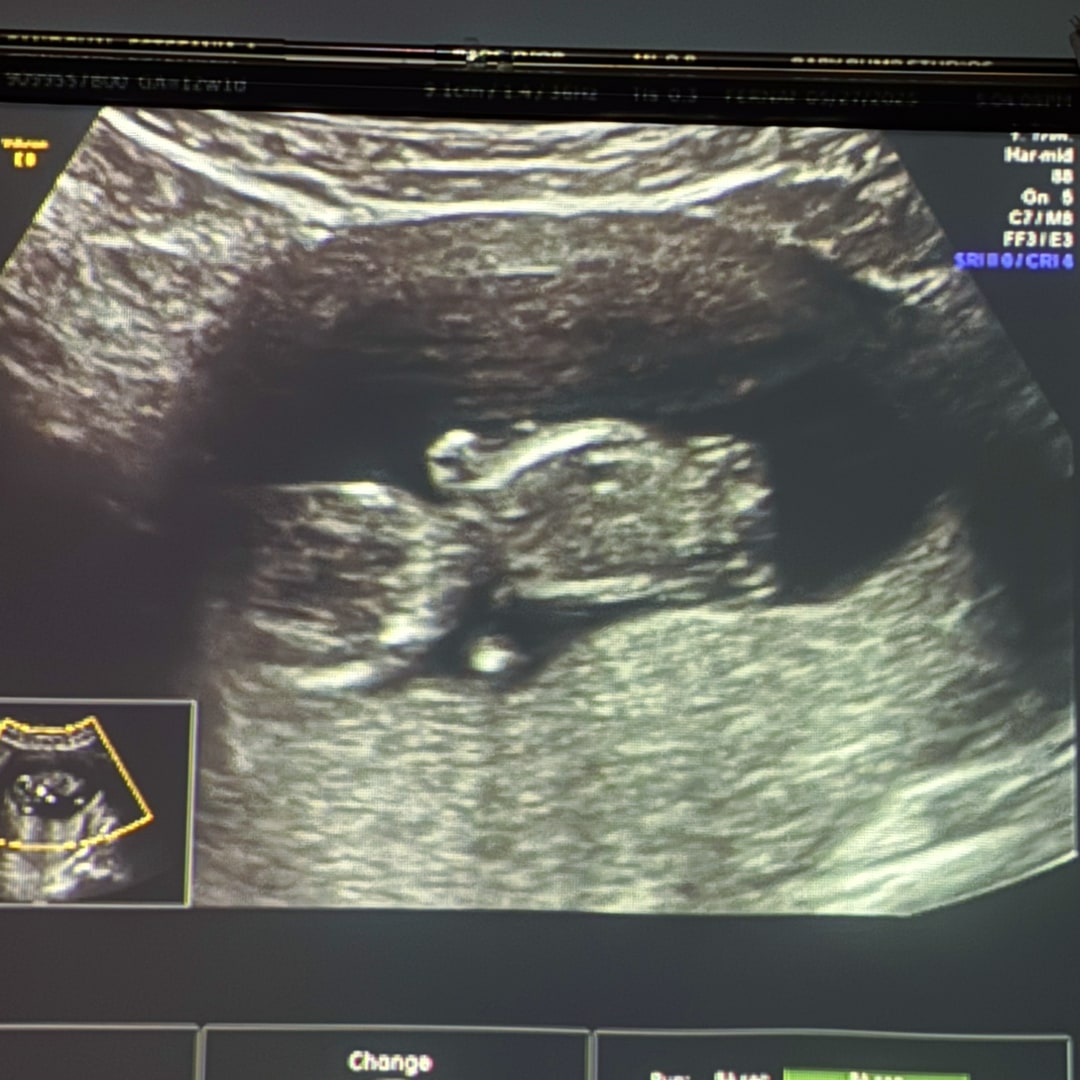 Photo shared by Estefania for their Babylist baby registry.