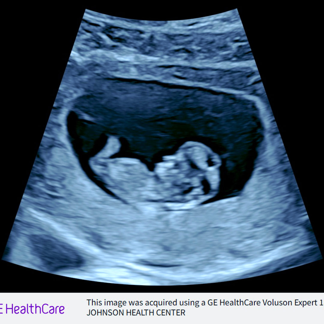 Photo shared by Ashley for their Babylist baby registry.