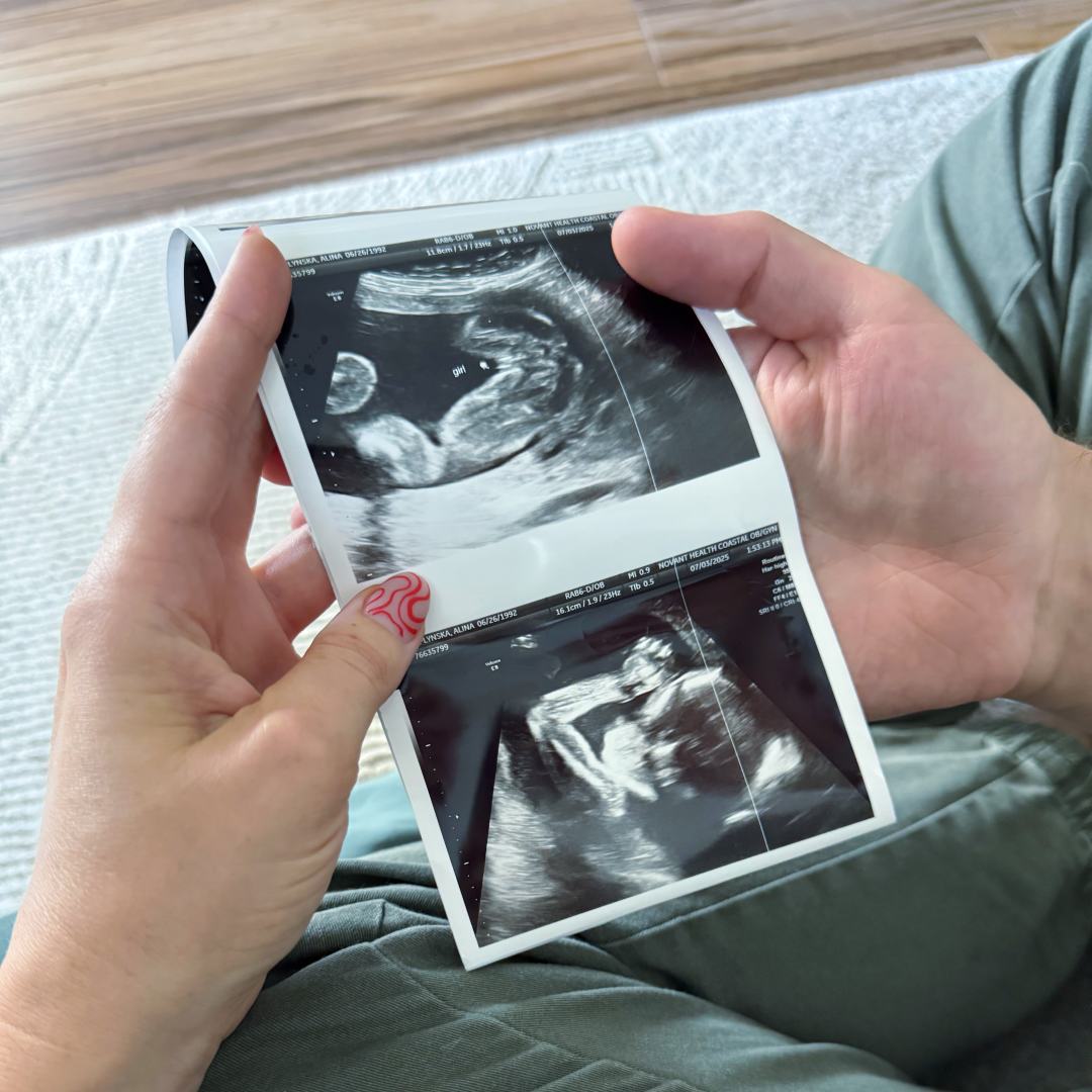 Photo shared by Alina for their Babylist baby registry.
