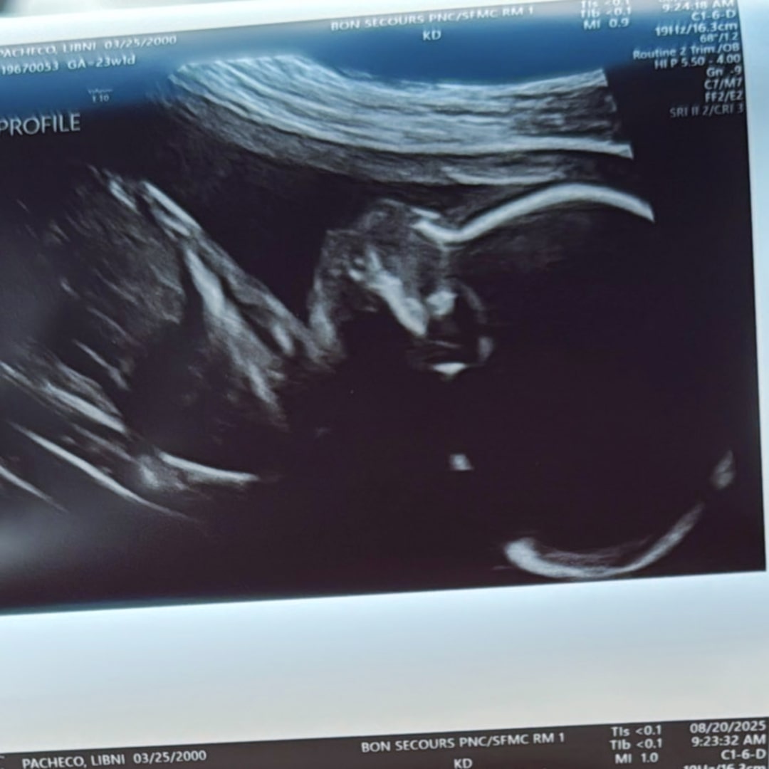 Photo shared by Libni for their Babylist baby registry.