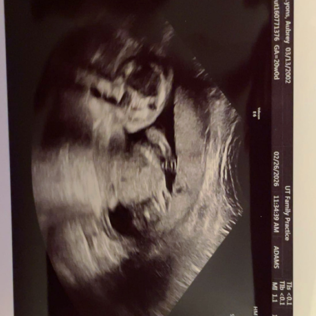 Photo shared by Aubrey for their Babylist baby registry.