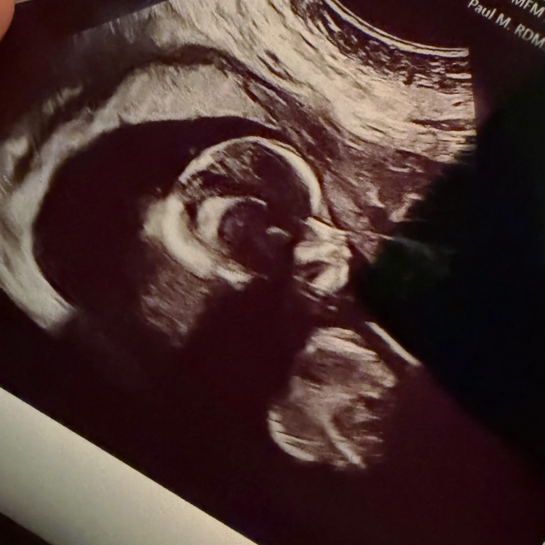 Photo shared by Aniya for their Babylist baby registry.