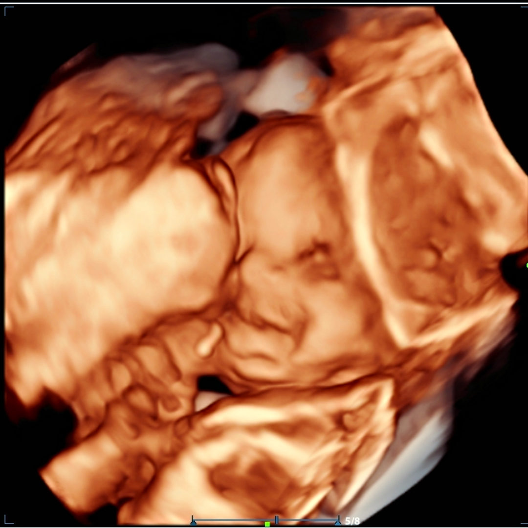 Photo shared by Larmonica for their Babylist baby registry.