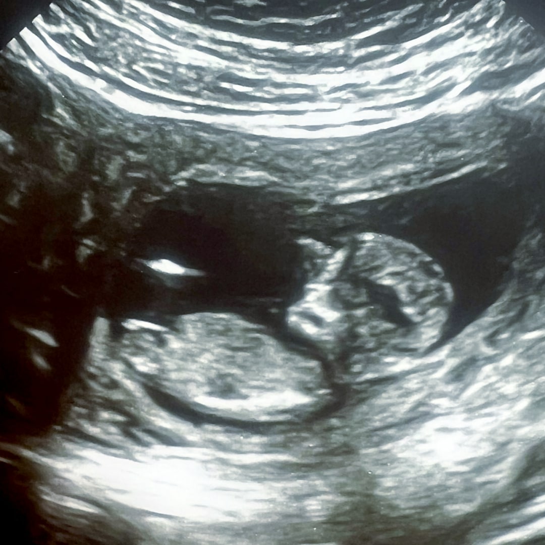 Photo shared by Heather for their Babylist baby registry.