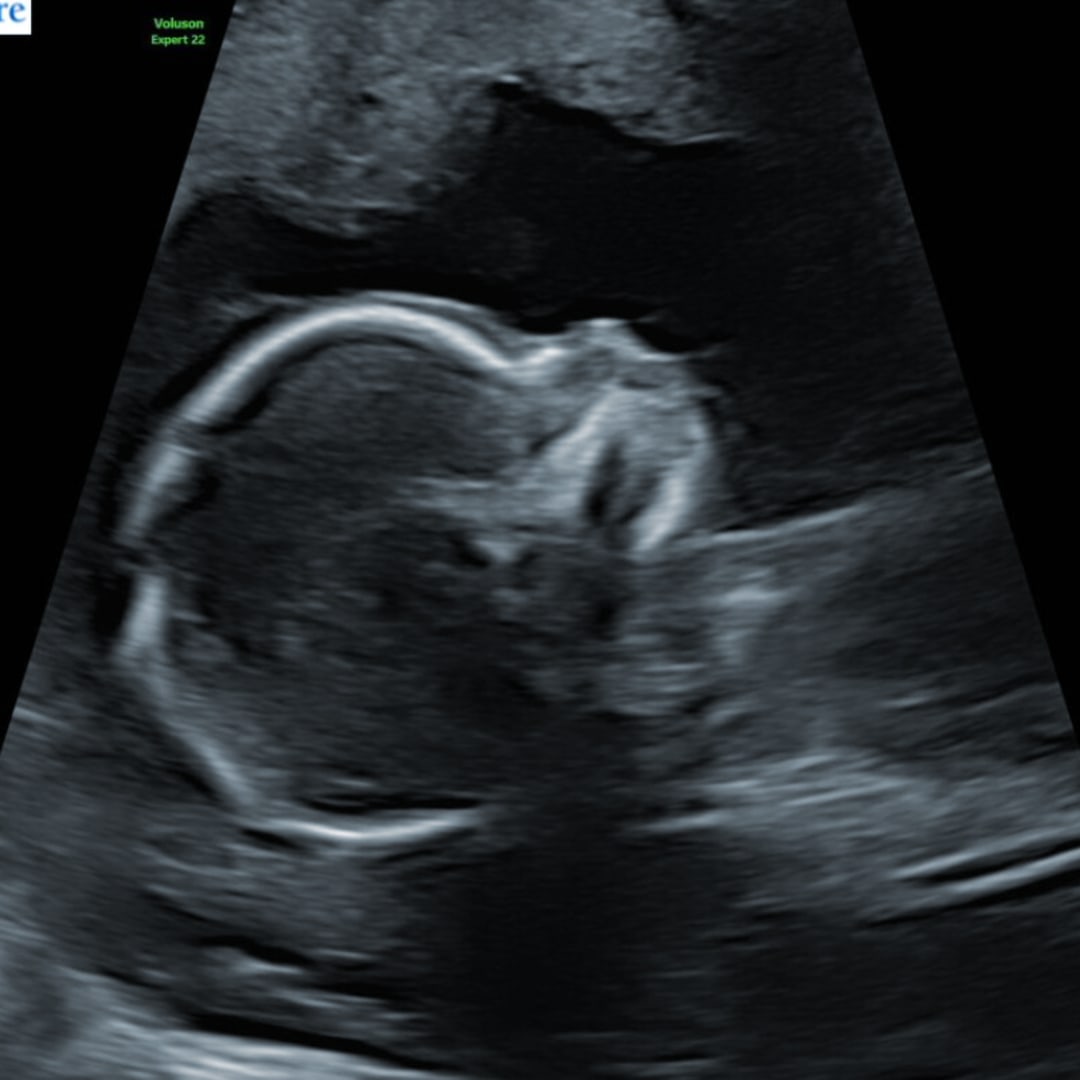 Photo shared by Alyssia for their Babylist baby registry.