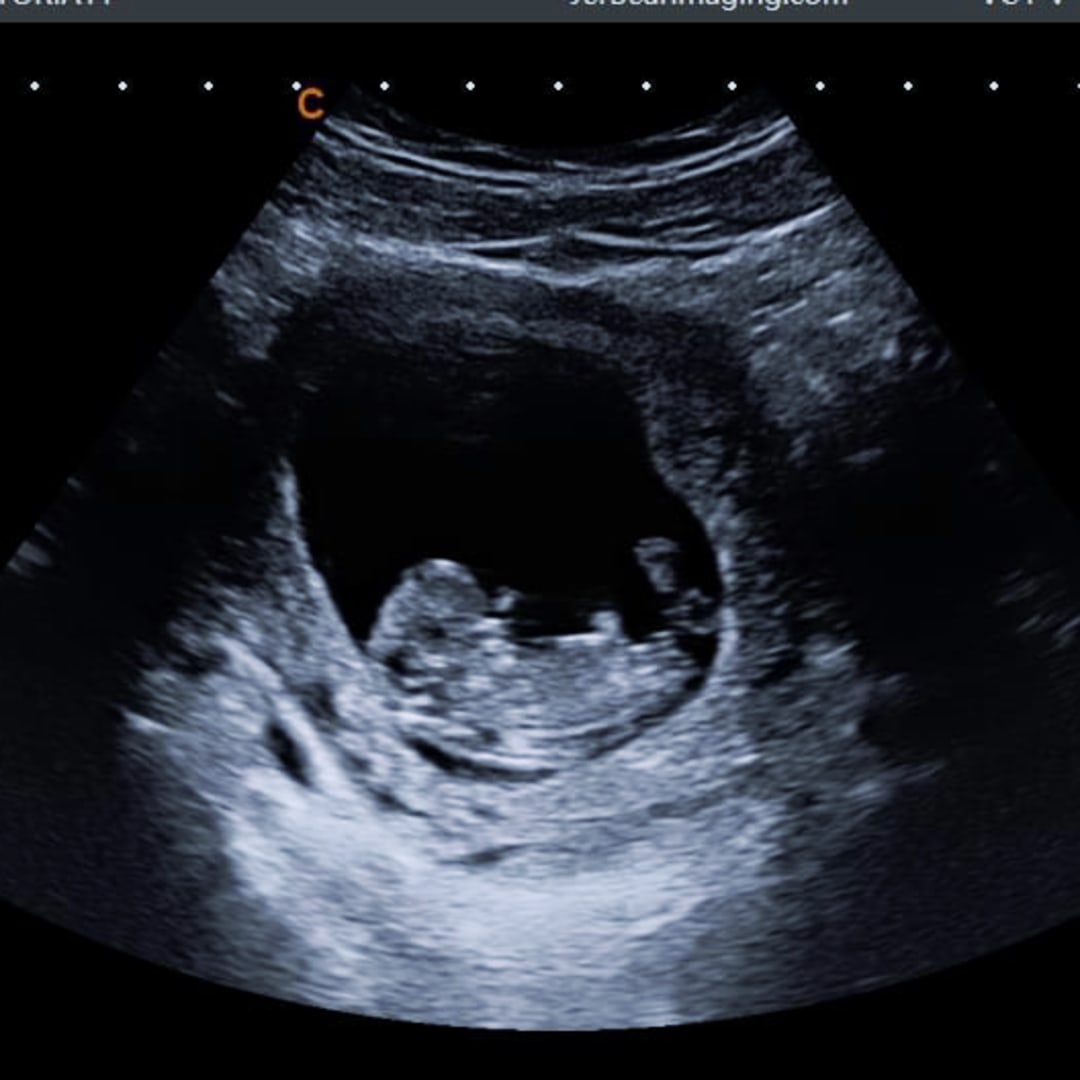 Photo shared by Victoria for their Babylist baby registry.