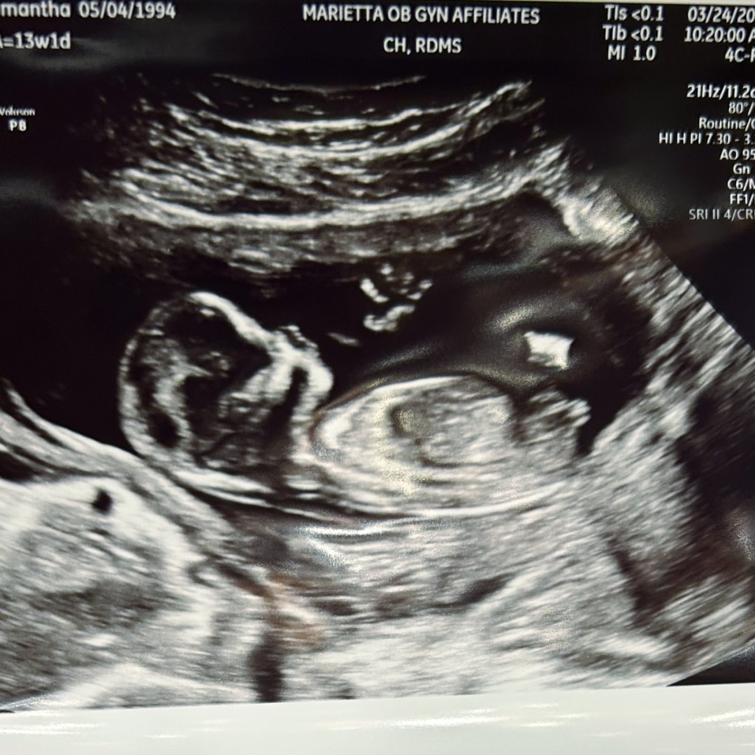 Photo shared by Samantha for their Babylist baby registry.