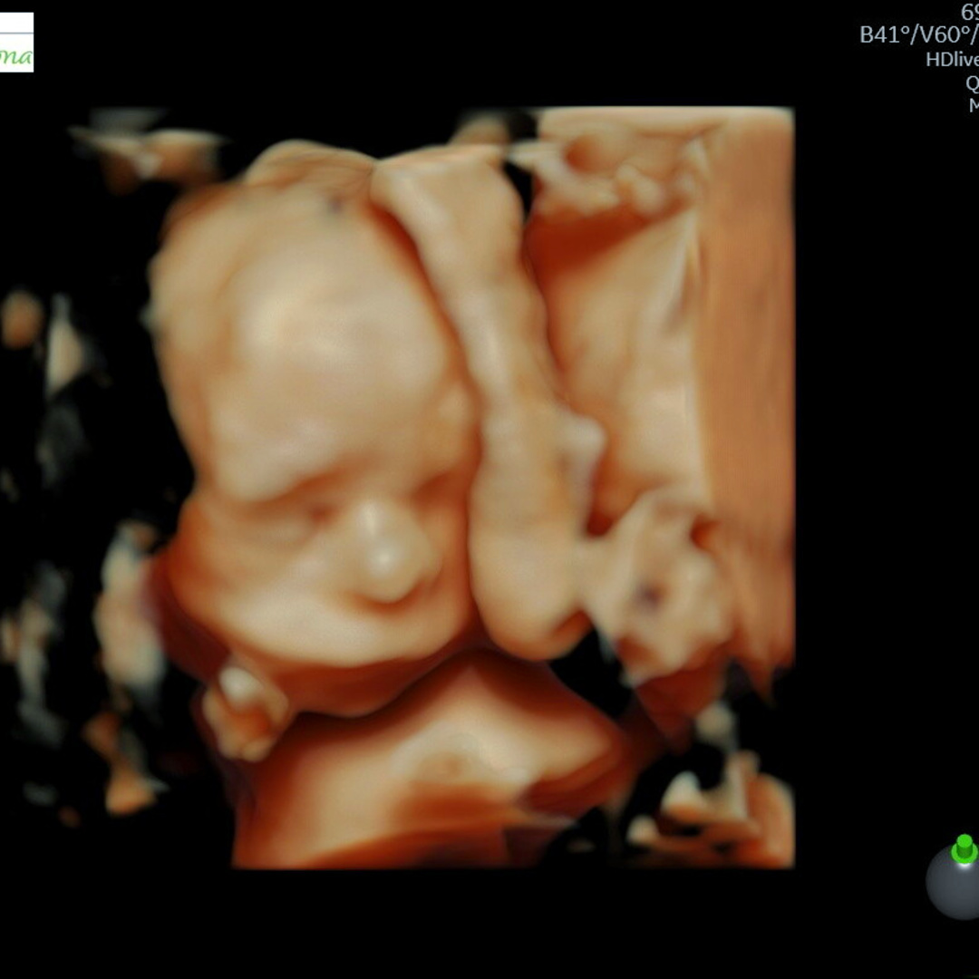 Photo shared by Eliza for their Babylist baby registry.