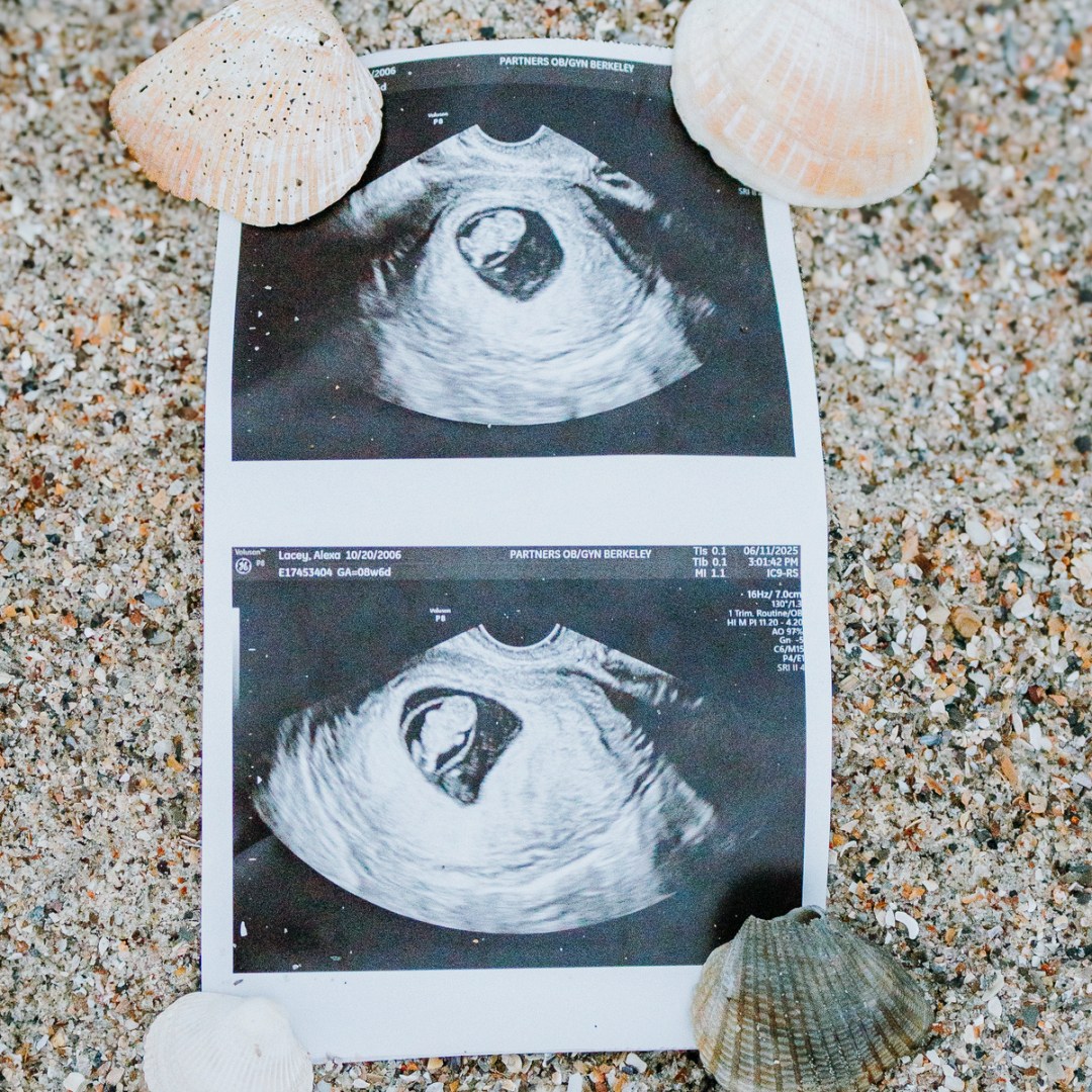 Photo shared by Alexa for their Babylist baby registry.