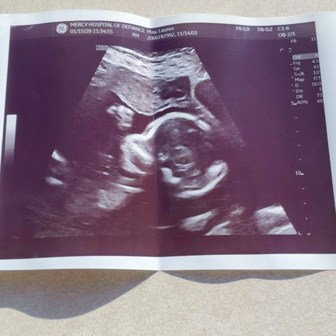 Photo shared by Lauren for their Babylist baby registry.