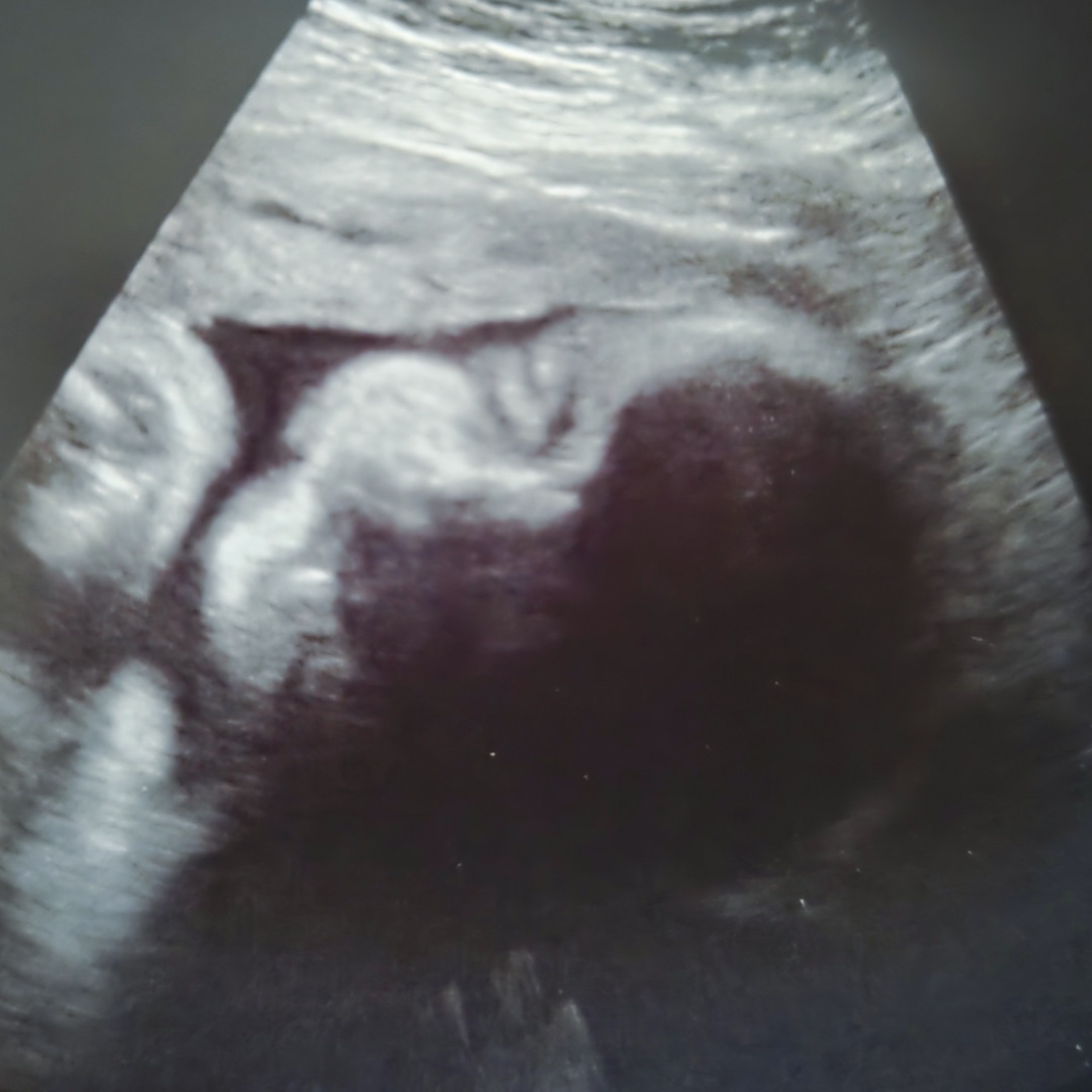 Photo shared by Ashley for their Babylist baby registry.