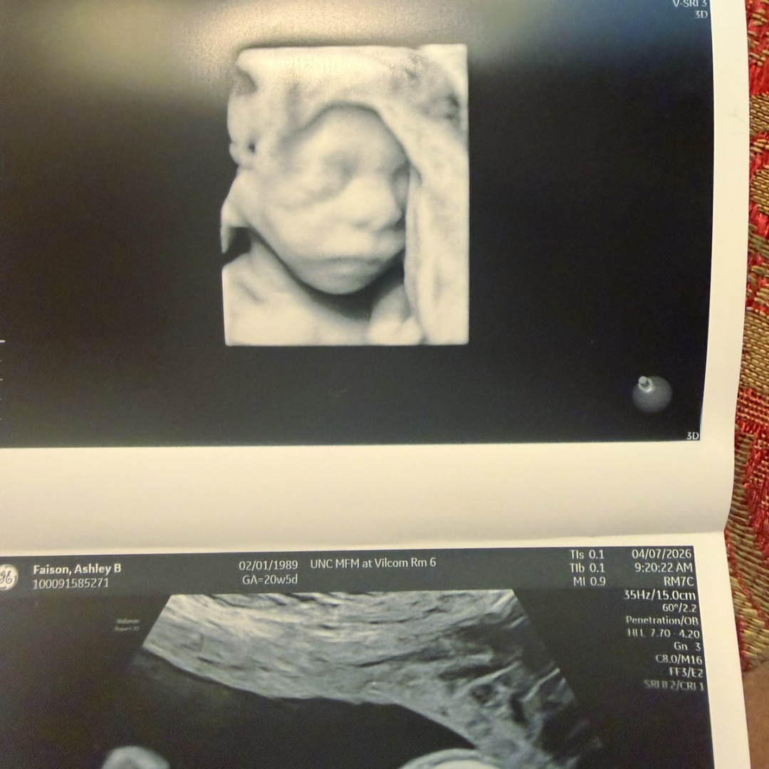 Photo shared by Ashley for their Babylist baby registry.