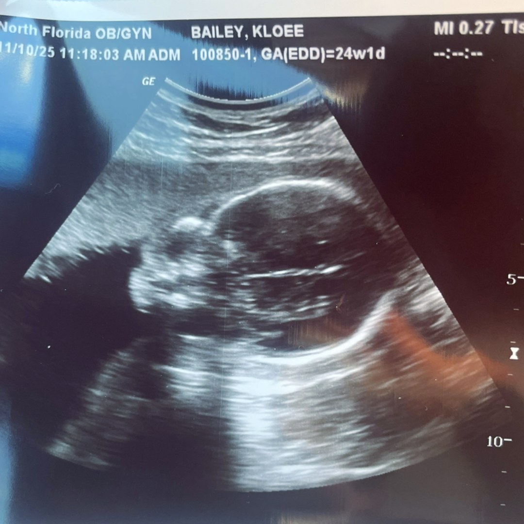 Photo shared by Kloee for their Babylist baby registry.