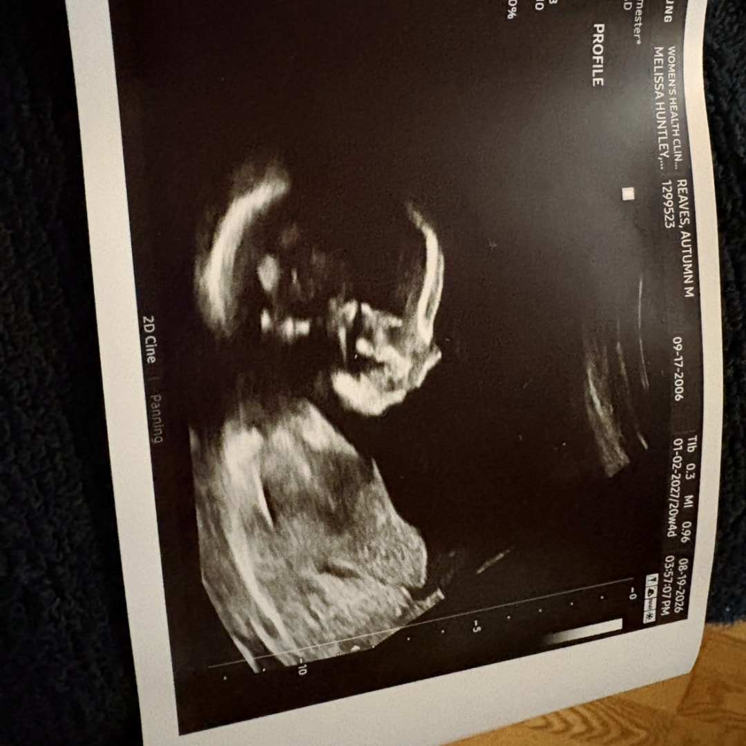 Photo shared by Autumn for their Babylist baby registry.