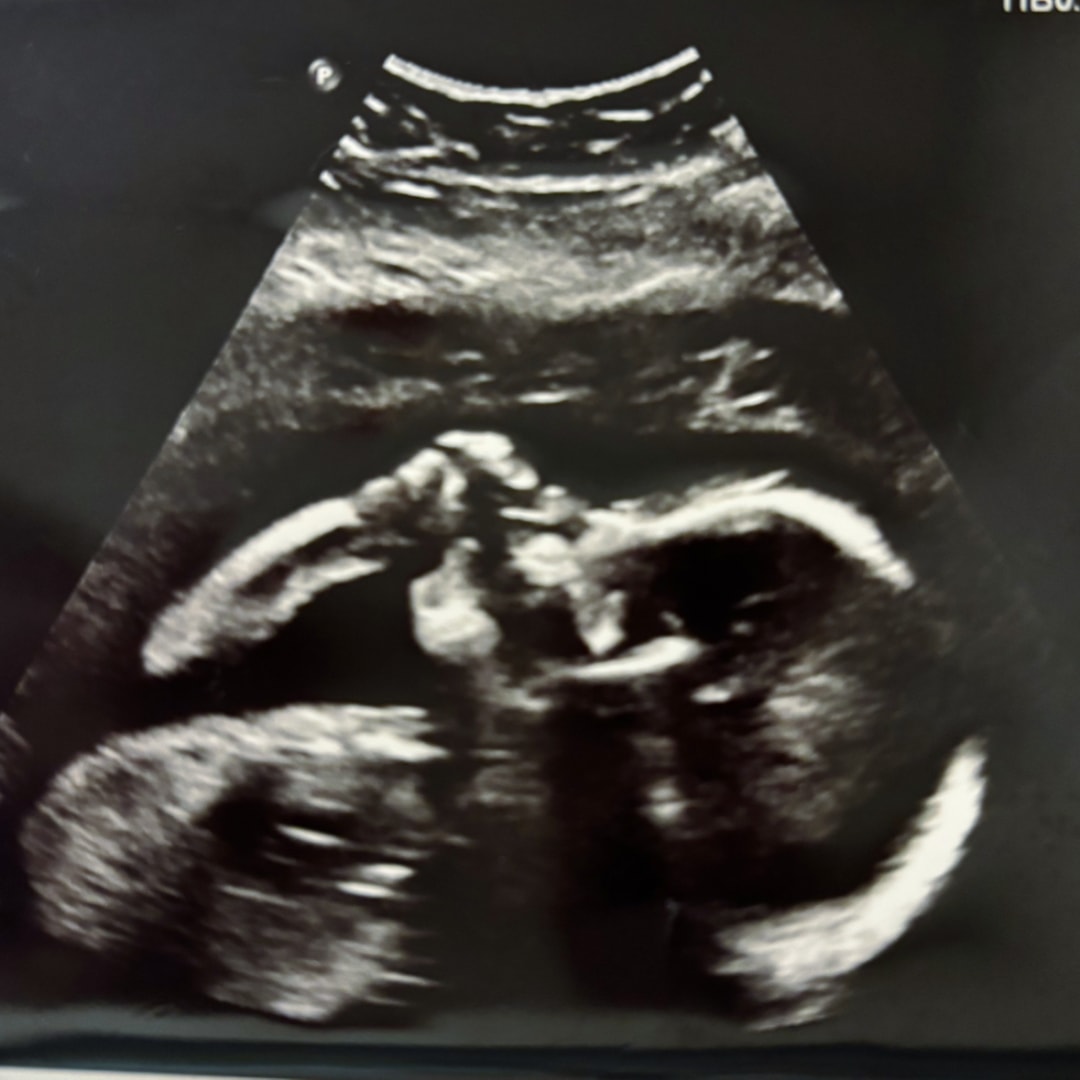 Photo shared by Briza for their Babylist baby registry.