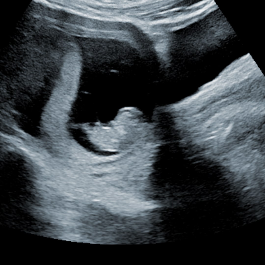 Photo shared by Deborah for their Babylist baby registry.
