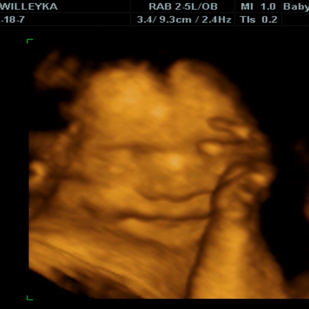 Photo shared by Willeyka for their Babylist baby registry.