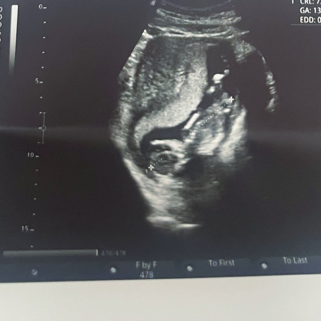 Photo shared by Dasia for their Babylist baby registry.