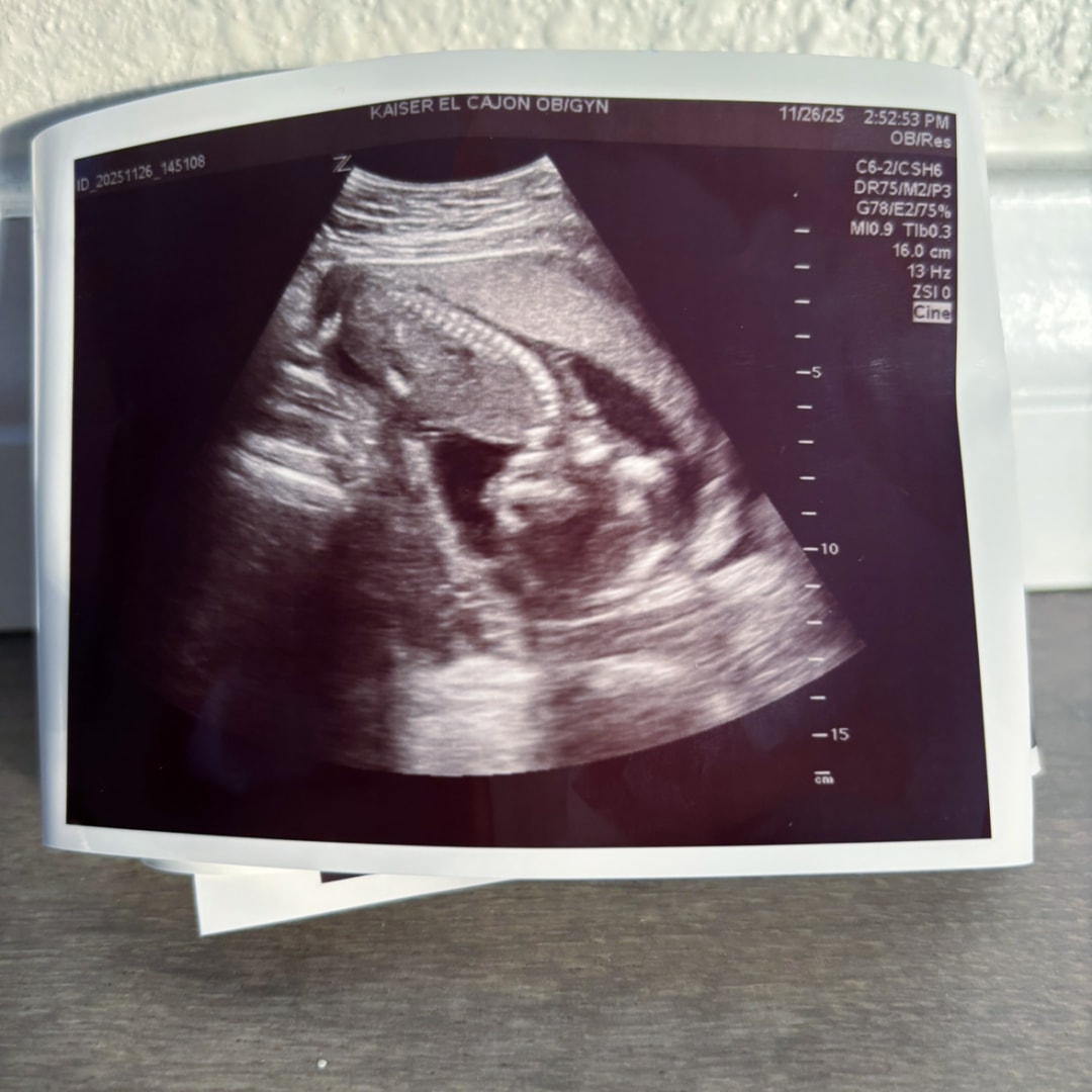 Photo shared by Carmynn for their Babylist baby registry.