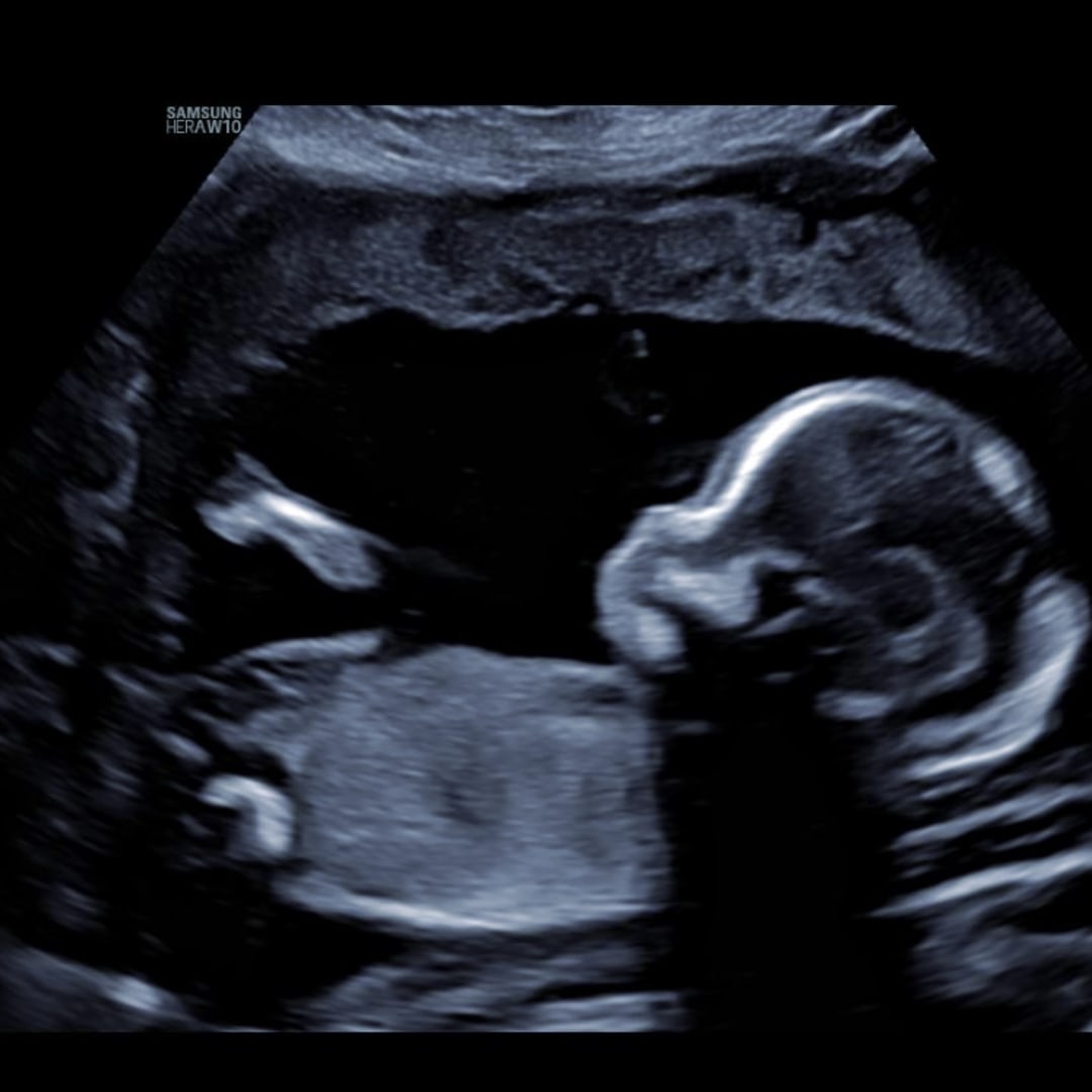 Photo shared by Caroline for their Babylist baby registry.