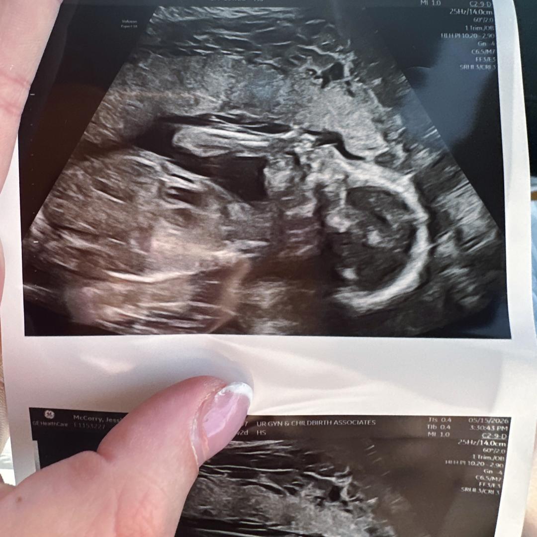 Photo shared by Jessica for their Babylist baby registry.