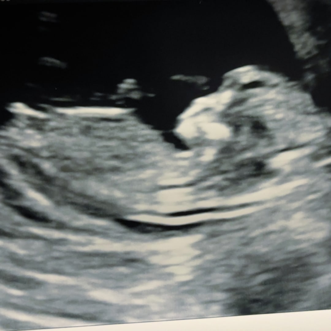 Photo shared by Kandice for their Babylist baby registry.